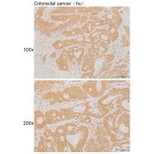 Solarbio K111925P Anti-STAT6 Polyclonal Antibody