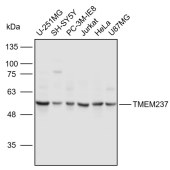 Solarbio K110943P Anti-TMEM237 Polyclonal Antibody