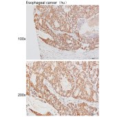 Solarbio K111475P Anti-HLA-DOA Polyclonal Antibody