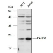 Solarbio K111234P Anti-FAHD1 Polyclonal Antibody
