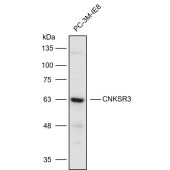 Solarbio K110715P Anti-CNKSR3 Polyclonal Antibody