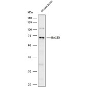 Solarbio K111937P Anti-BACE1 Polyclonal Antibody