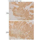 Solarbio K111914P Anti-HKDC1 Polyclonal Antibody