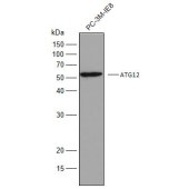 Solarbio K009933P Anti-ATG12 Polyclonal Antibody