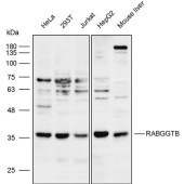 Solarbio K111784P Anti-RABGGTB Polyclonal Antibody