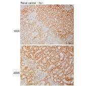 Solarbio K110839P Anti-ABCB7 Polyclonal Antibody