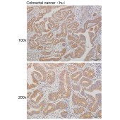 Solarbio K111250P Anti-ADCK1 Polyclonal Antibody