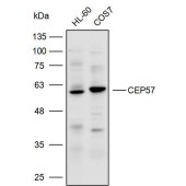 Solarbio K110547P Anti-CEP57 Polyclonal Antibody