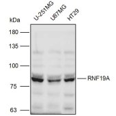 Solarbio K111116P Anti-RNF19A Polyclonal Antibody