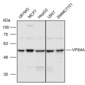 Solarbio K110996P Anti-VPS4A Polyclonal Antibody