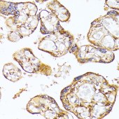 Solarbio K009987P Anti-VEGFR1 Polyclonal Antibody