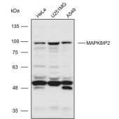 Solarbio K111099P Anti-MAPK8IP2 Polyclonal Antibody