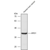 Solarbio K111448P Anti-ARG1 Polyclonal Antibody