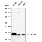 Solarbio K111852P Anti-CRABP2 Polyclonal Antibody