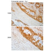 Solarbio K112139P Anti-TULP3 Polyclonal Antibody