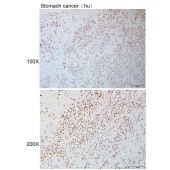 Solarbio K110922P Anti-RAD17 Polyclonal Antibody