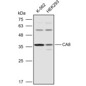 Solarbio K110910P Anti-CA8 Polyclonal Antibody