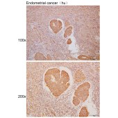 Solarbio K111662P Anti-LRR1 Polyclonal Antibody