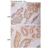 Solarbio K111087P Anti-MME Polyclonal Antibody