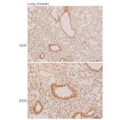 Solarbio K110716P Anti-RFX2 Polyclonal Antibody