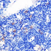 Solarbio K009992P Anti-TGFB1 Polyclonal Antibody