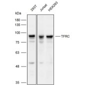 Solarbio K111932P Anti-TFRC Polyclonal Antibody