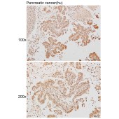 Solarbio K111257P Anti-RFPL4A/RFPL4AL1 Polyclonal Antibody