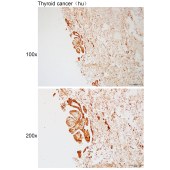 Solarbio K112128P Anti-TTC27 Polyclonal Antibody