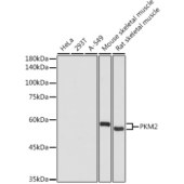 Solarbio K009920P Anti-PKM2 Polyclonal Antibody