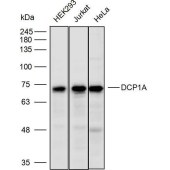 Solarbio K110541P Anti-DCP1A Polyclonal Antibody