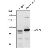 Solarbio K110903P Anti-APLP2 Polyclonal Antibody