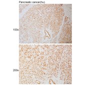 Solarbio K111081P Anti-DYR1A Polyclonal Antibody