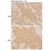 Solarbio K111909P Anti-PARVG Polyclonal Antibody