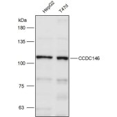 Solarbio K111438P Anti-CCDC146 Polyclonal Antibody