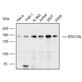 Solarbio K110605P Anti-ERCC6L Polyclonal Antibody