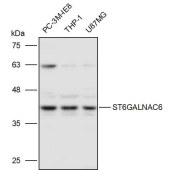 Solarbio K111004P Anti-ST6GALNAC6 Polyclonal Antibody