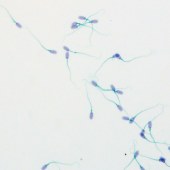 Solarbio G2570 精子形态学染色试剂盒(Shorr法)