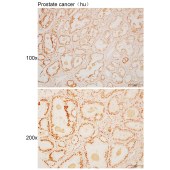 Solarbio K110528P Anti-INO80C Polyclonal Antibody