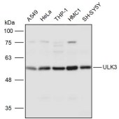 Solarbio K111236P Anti-ULK3 Polyclonal Antibody