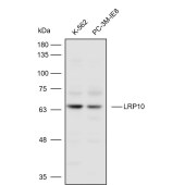 Solarbio K110819P Anti-LRP10 Polyclonal Antibody