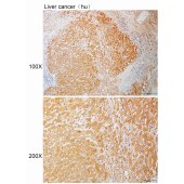 Solarbio K110911P Anti-RSPH3 Polyclonal Antibody