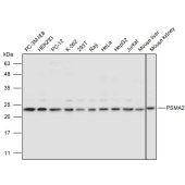 Solarbio K111027P Anti-PSMA2 Polyclonal Antibody