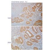 Solarbio K110834P Anti-NOTCH2(Cleaved-Ala1734) Polyclonal Antibody