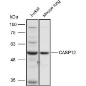 Solarbio K111263P Anti-CASP12 Polyclonal Antibody