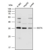 Solarbio K111650P Anti-SGTA Polyclonal Antibody