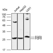 Solarbio K112126P Anti-FGF9 Polyclonal Antibody