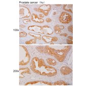 Solarbio K111040P Anti-SCGB1A1 Polyclonal Antibody