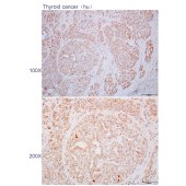 Solarbio K110612P Anti-ADAT1 Polyclonal Antibody