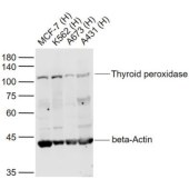 Solarbio K009949P Anti-Thyroid peroxidase Polyclonal antibody
