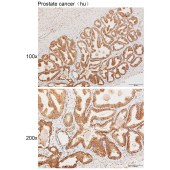 Solarbio K111468P Anti-DTX2 Polyclonal Antibody